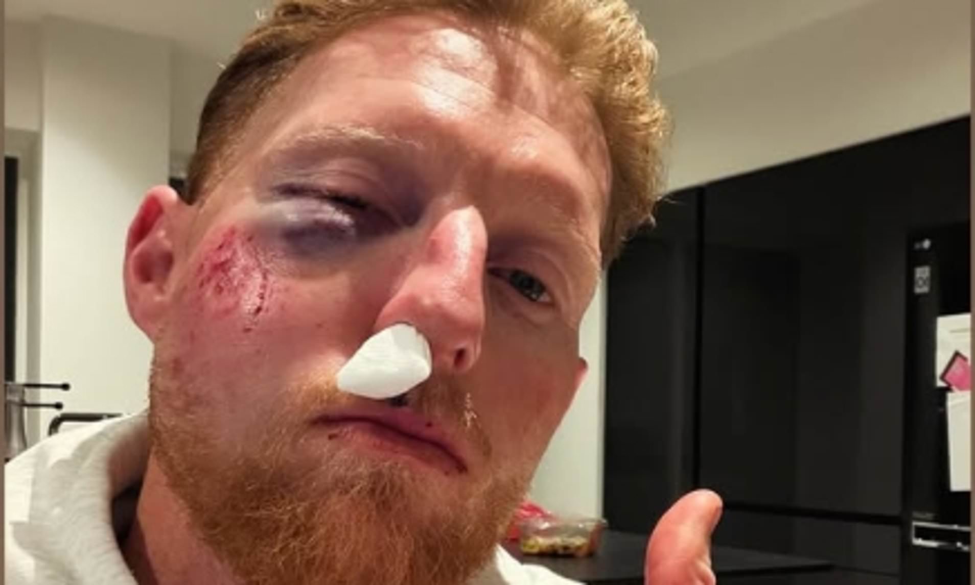 Stokes reveals he is 'lucky' to be alive after horror cricket injury ...