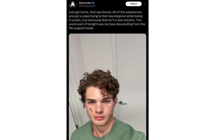 Influencer Clavicular speaks out after suspected overdose hospitalization