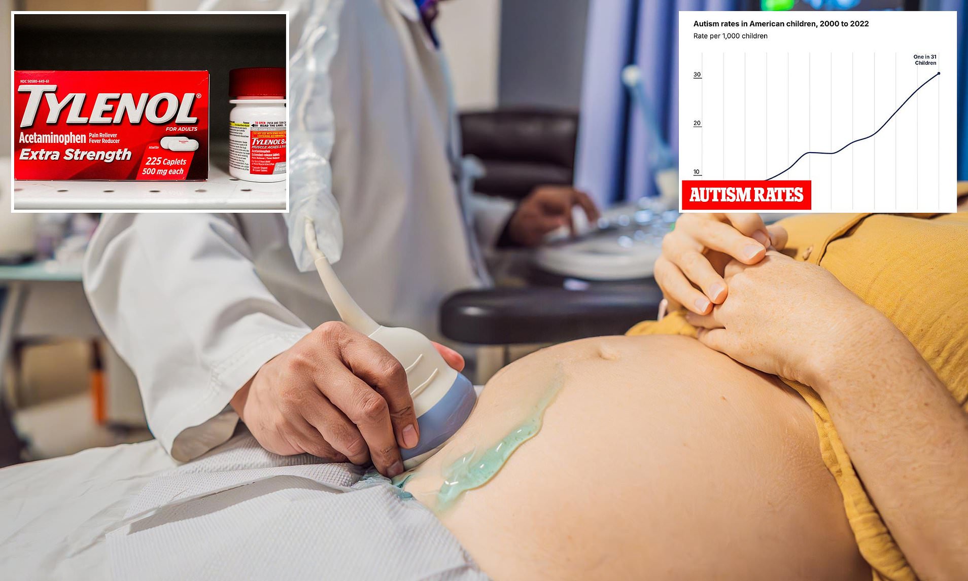 Tylenol use in pregnancy is not linked to 'significant' risk of autism ...