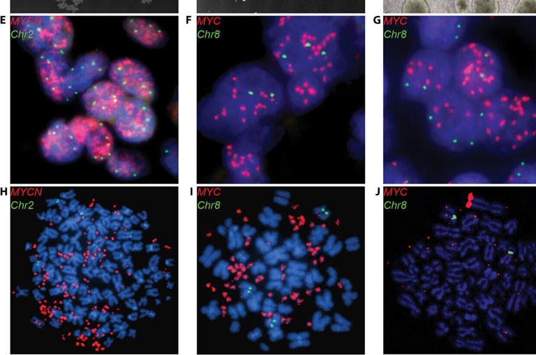 3D brain tumor organoids provide new scientific opportunities for ...