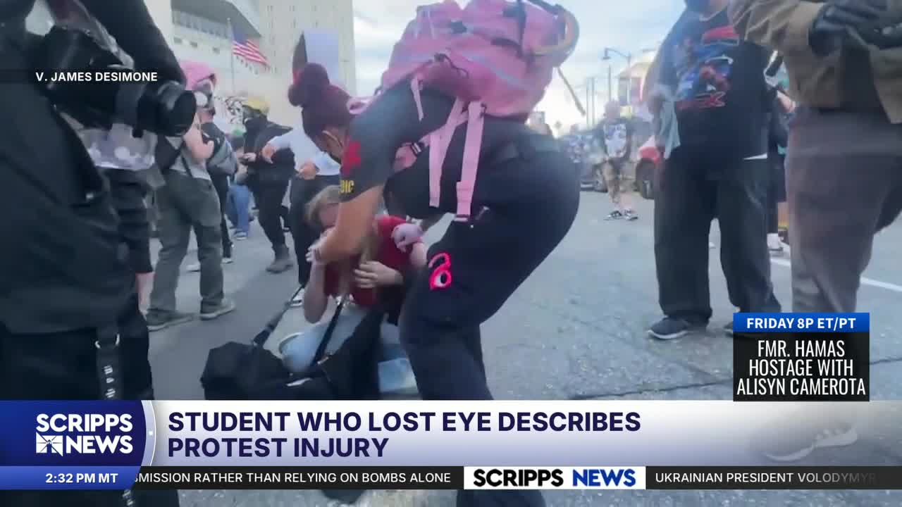 'This is permanent': College student who lost eye photographing protest ...