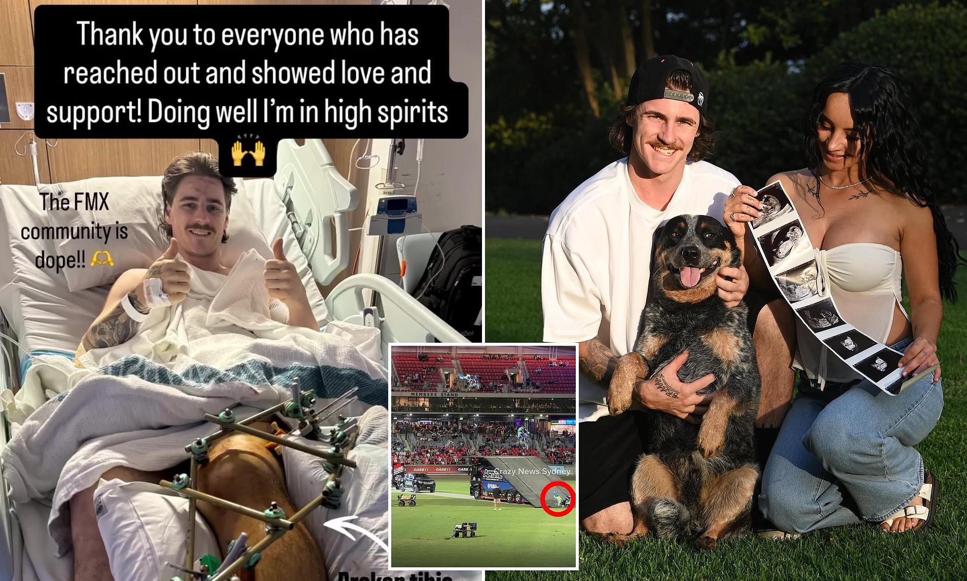 Motocross rider's message from hospital after catastrophic accident at ...