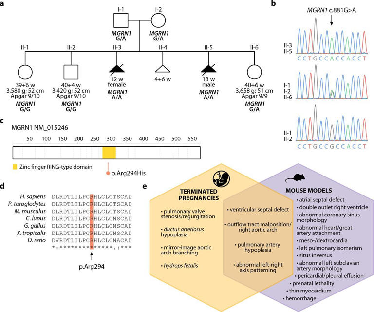 Rare MGRN1 gene variant tied to fetal heart malformations