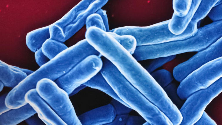 After near eradication, the world's deadliest infection is making a ...