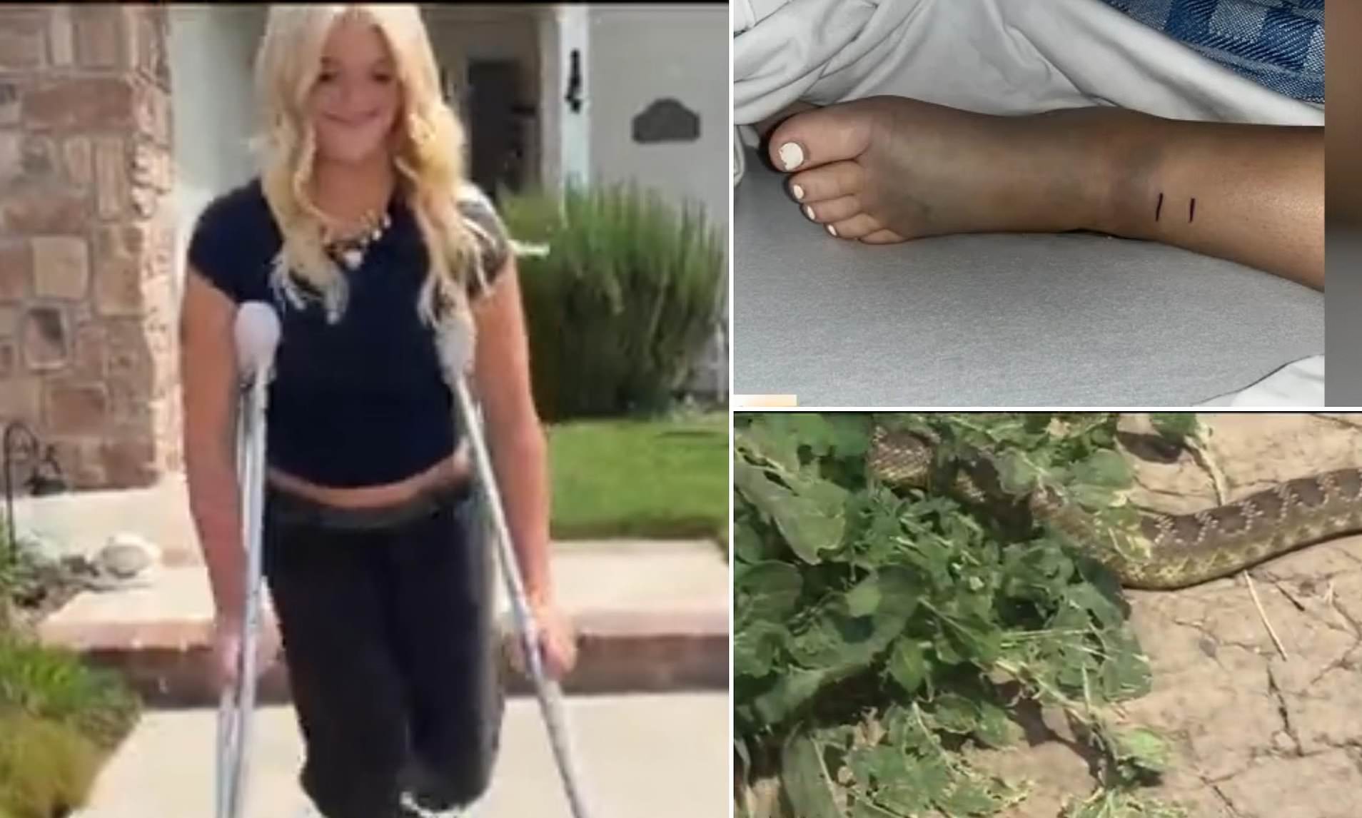 Teen girl left fighting for her life after being bitten by a venomous ...