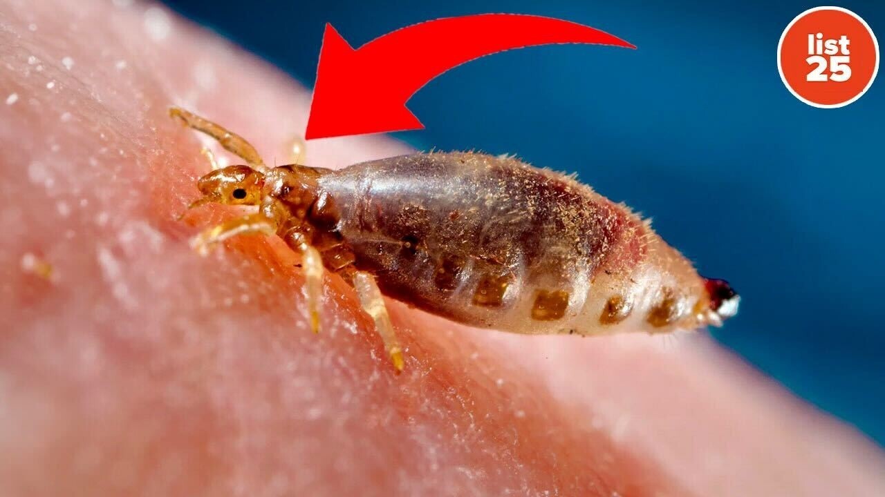 25 insects that call human bodies their home