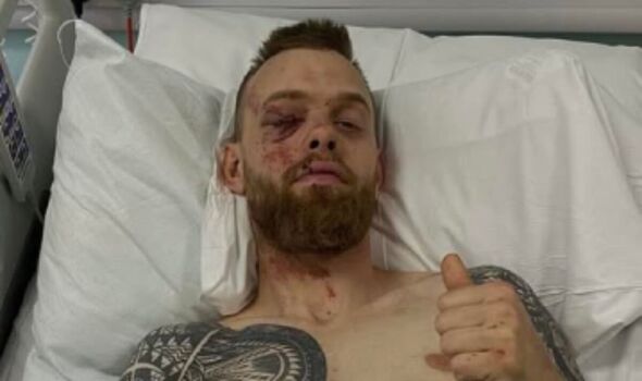 Horror motorcycle crash as speedway star rushed to hospital for major ...