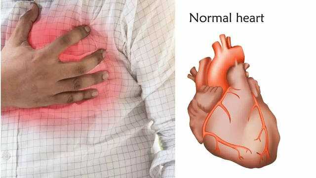 Recognizing early signs of heart weakness through leg symptoms