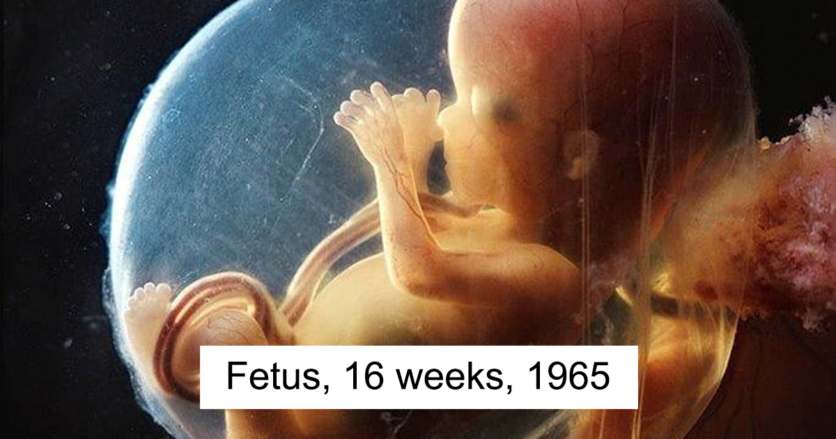 10 remarkable images offering a glimpse into the miracle of birth