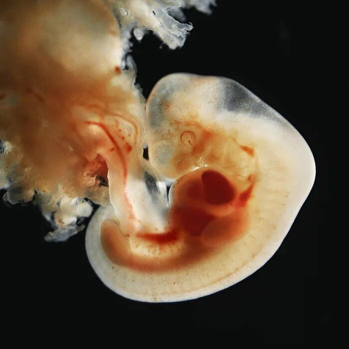 10 remarkable images offering a glimpse into the miracle of birth
