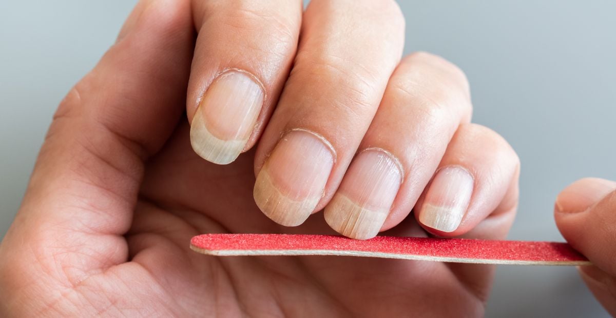 Ongles striés ce soin de pharmacie lisse l’ongle et offre +51 de — free download