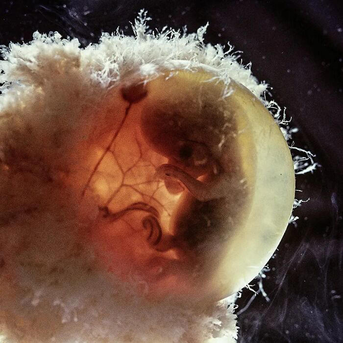 10 remarkable images offering a glimpse into the miracle of birth