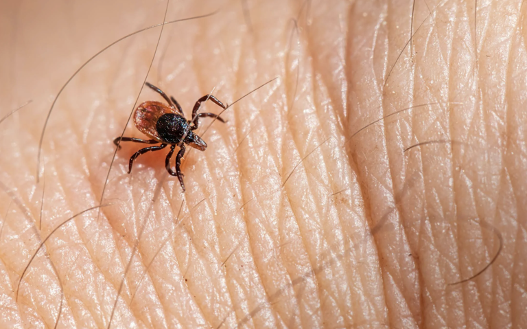 Worried about ticks this spring? These 7 yard fixes can help