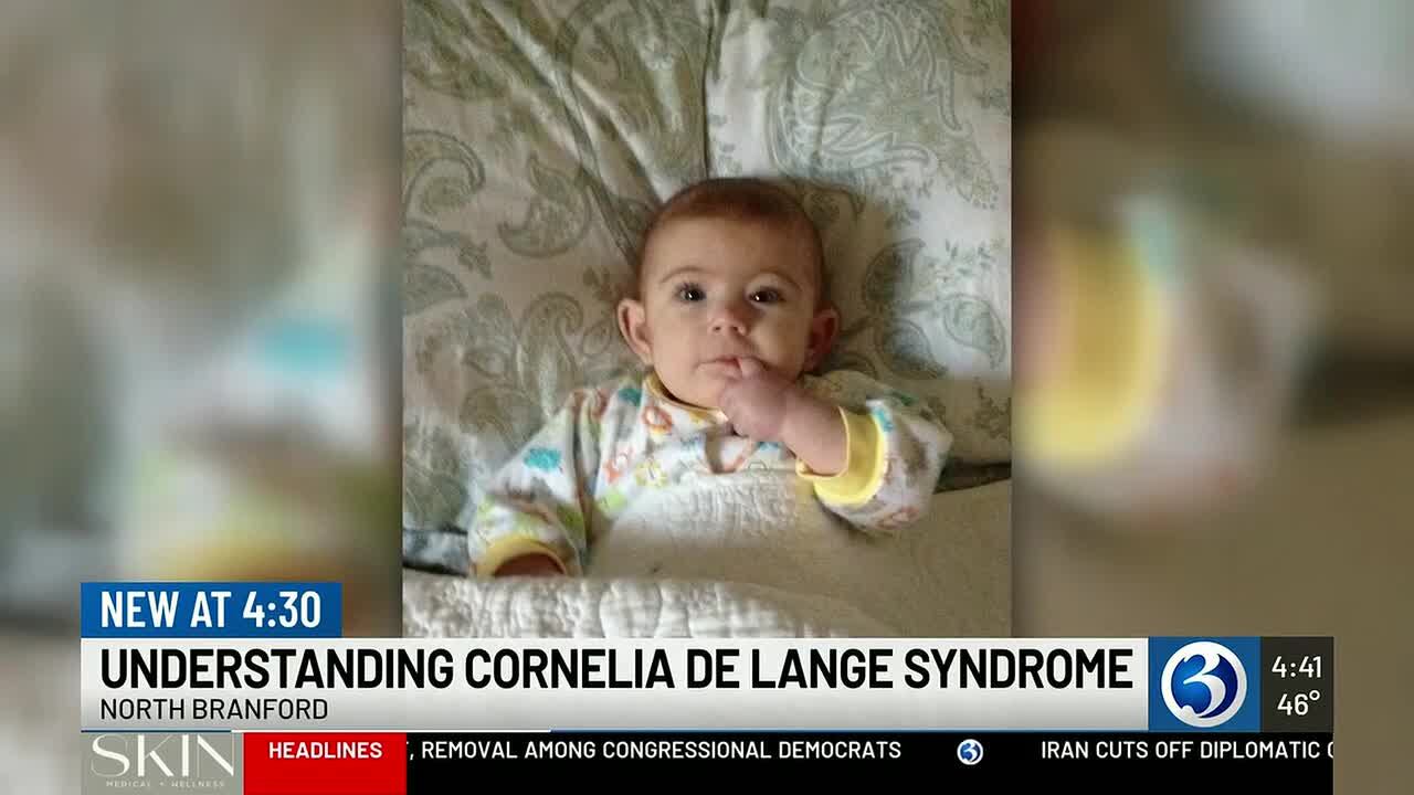 North Branford mom raises awareness for rare genetic syndrome affecting ...