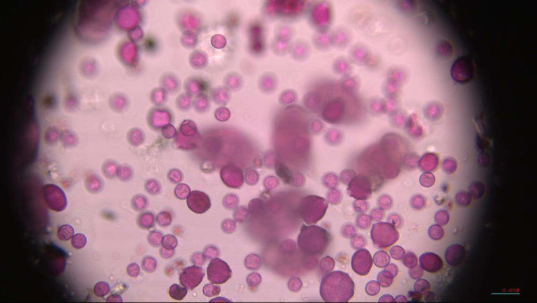 Pollen hits 'extreme' levels in Boise. See what's fueling your fall ...