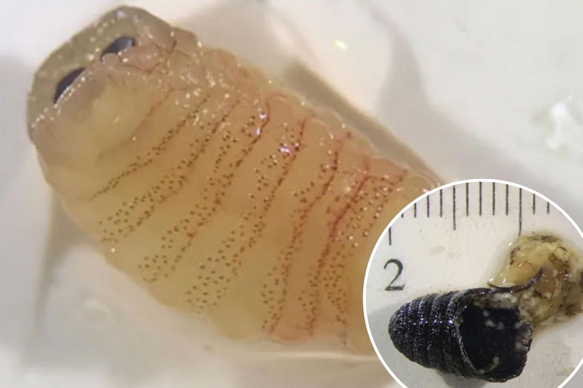Woman sneezes nearly 1-inch-long worms — how she got the biologically ...