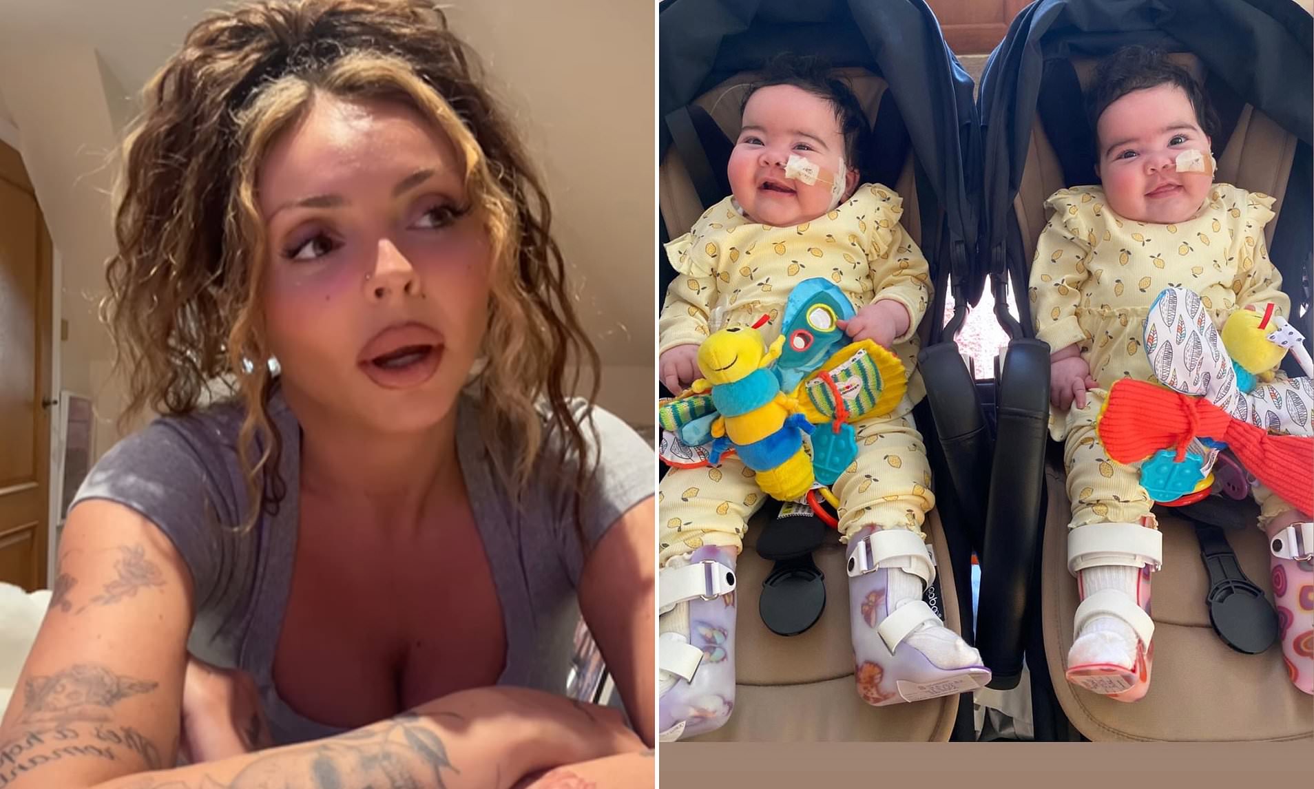 Jesy Nelson xúc động khi chia sẻ bức ảnh ngọt ngào về cặp song sinh của mình đang đeo nẹp chân.