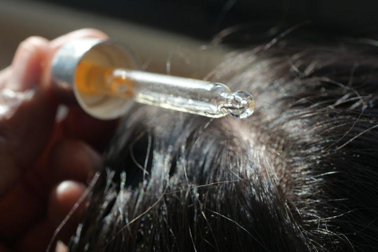 Hair growth products sold on Amazon are recalled over poisoning risk