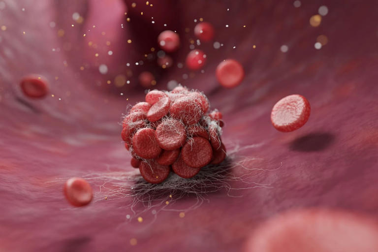 E2 raises $80m to advance VTE system’s commercialisation
