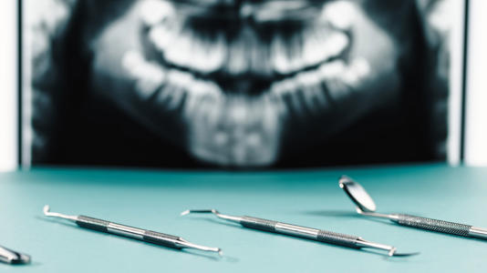 Anestesia general en odontología: cuándo se debe usar y qué riesgos existen