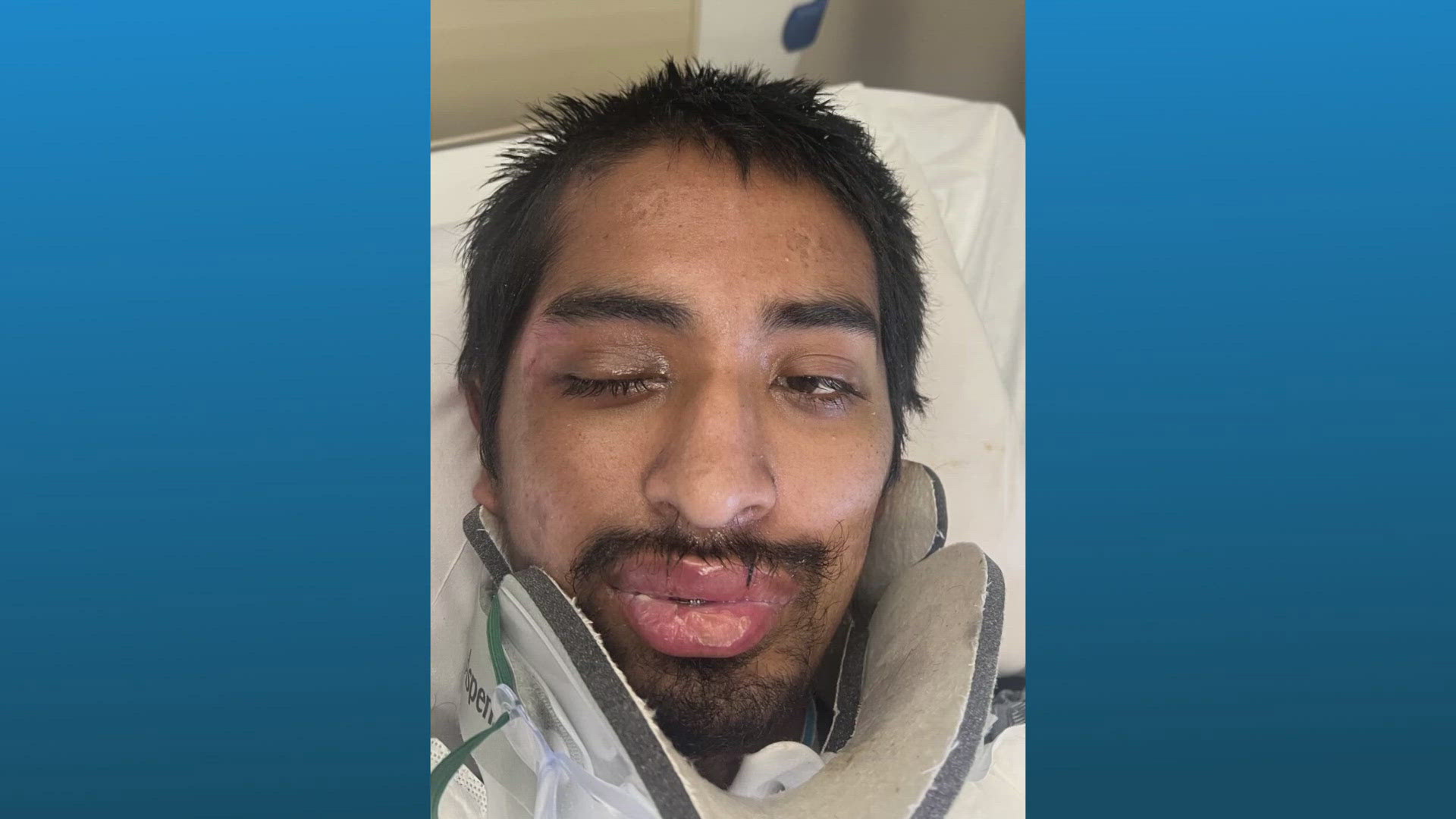 Hospital trying to identify man hit by a car