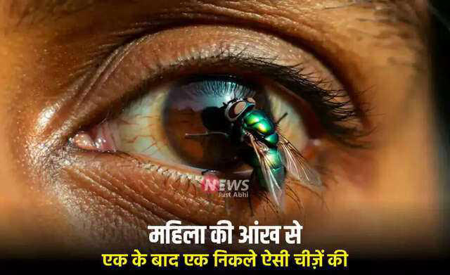 Unbelievable case: A woman's eye infested by parasites