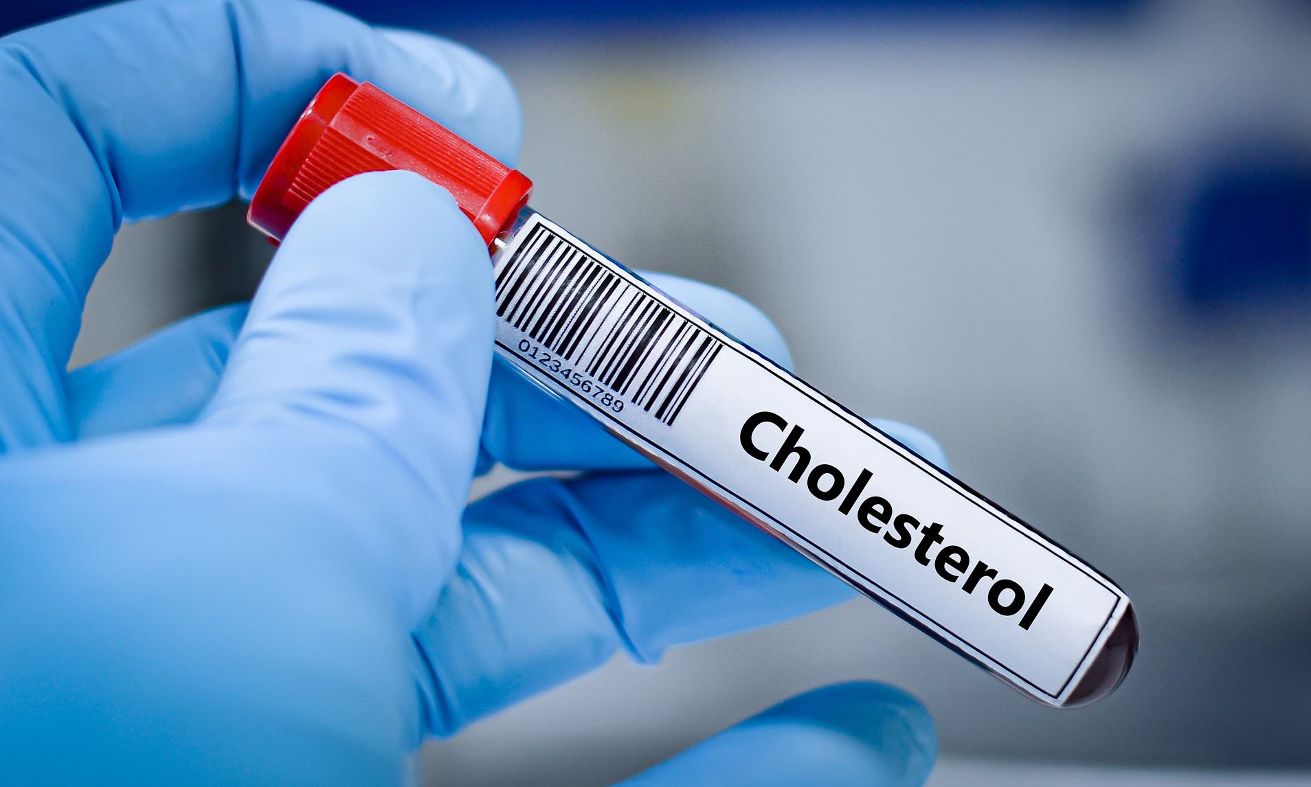 Researchers claim £36 cholesterol test is better predictor of heart ...