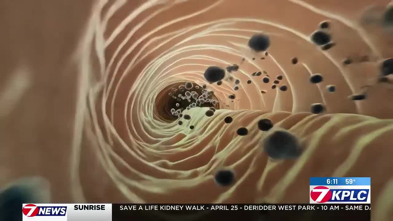 Protecting gut bacteria can prevent serious health problems