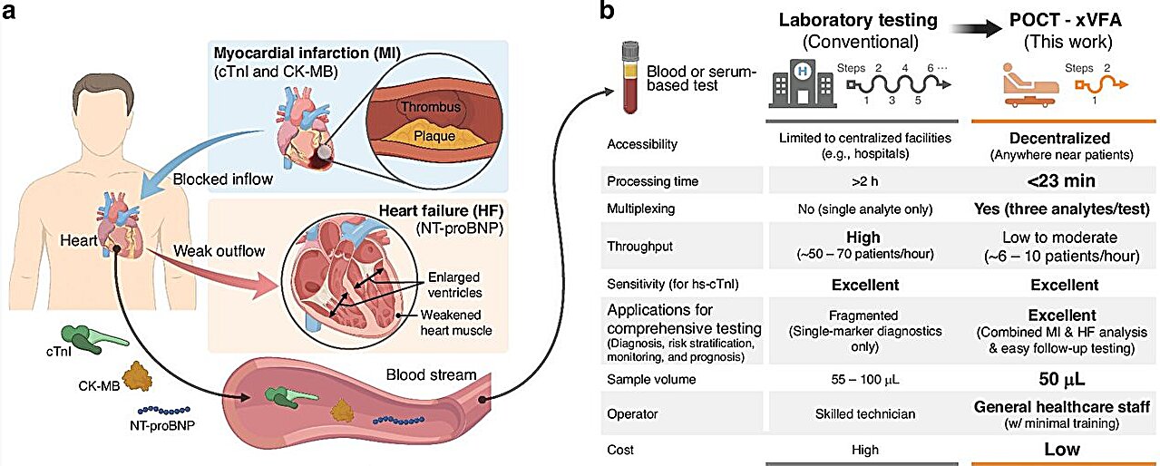 AI-powered portable sensor enables rapid and multiplexed cardiac ...
