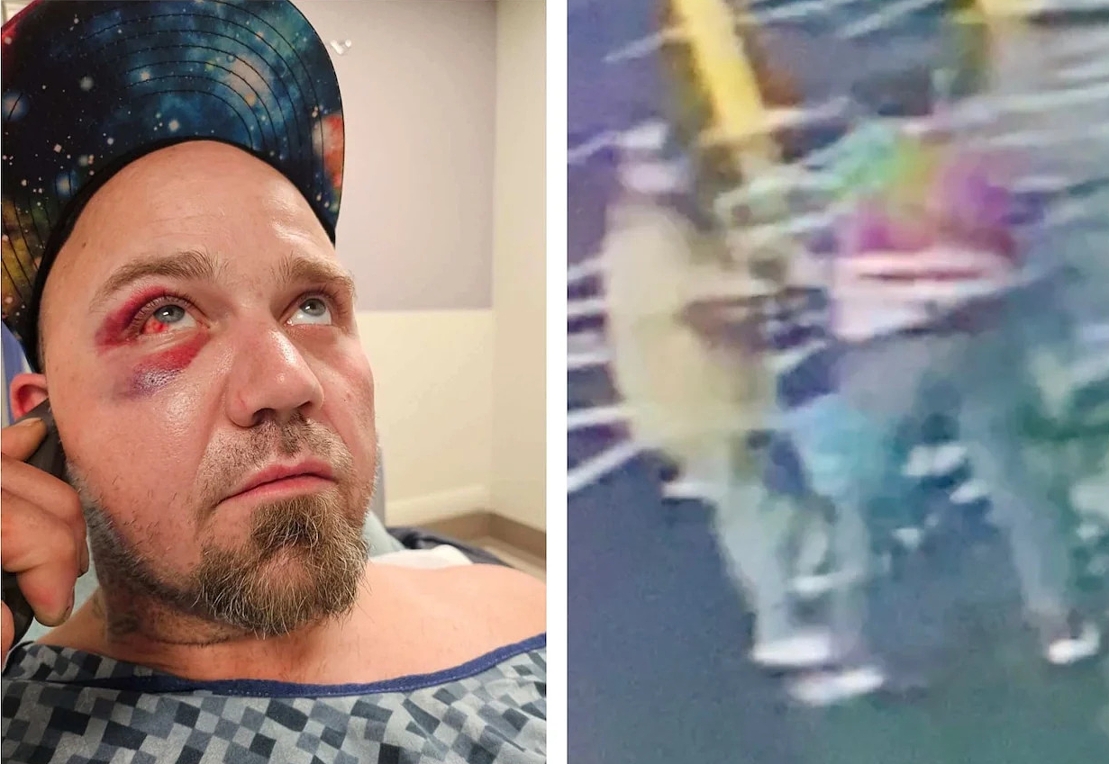 Kẻ trộm kiện ngược nhân viên siêu thị vì bị đuổi đánh