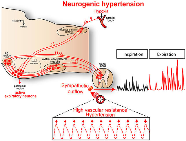 Scientists might have found a new cause of high blood pressure, and a ...