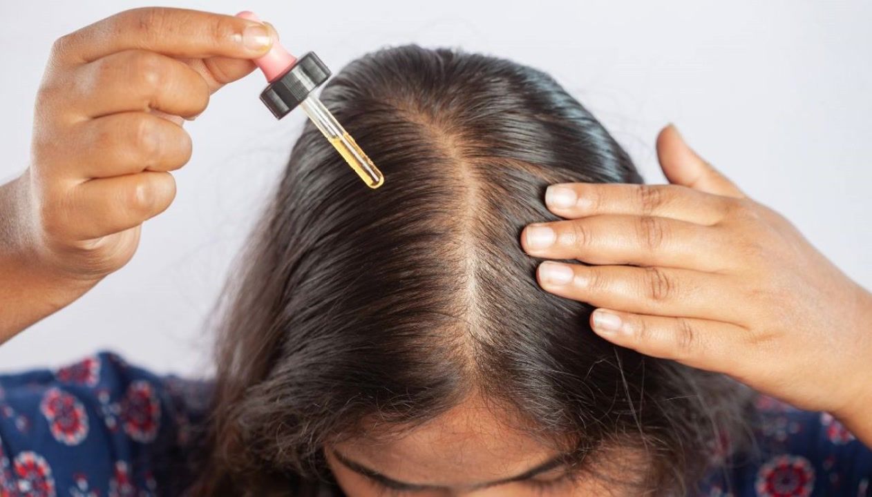 Is minoxidil covered by insurance? How to save big on hair loss treatment