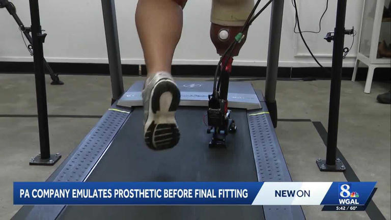 Medtech company develops technology that lets amputees test prosthetic ...