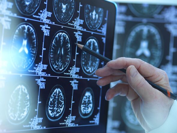 Bombshell review of dementia treatment makes worrying claim about ...
