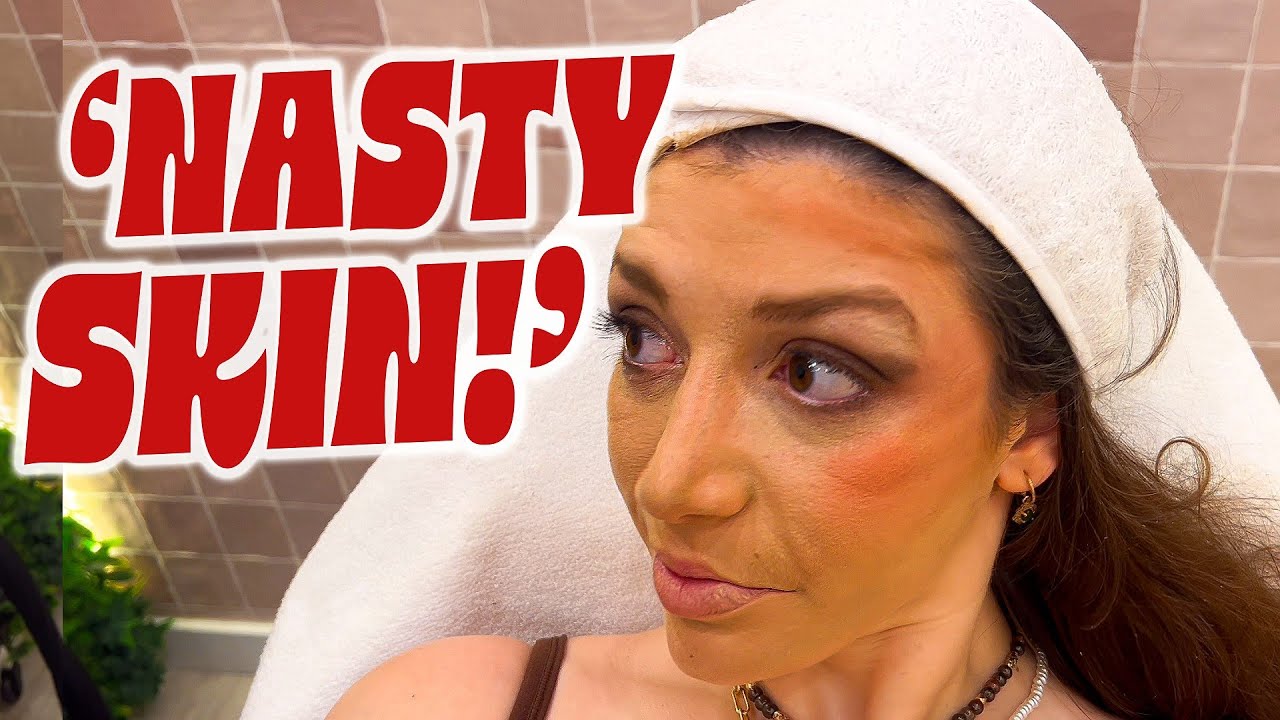 Skin texture issues cause a viral makeup artist meltdown