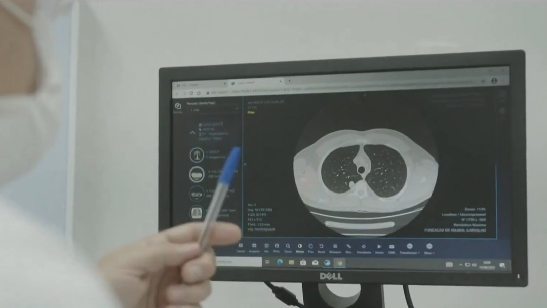 ‘I thought it was nothing': The dangerous trend doctors are noticing
