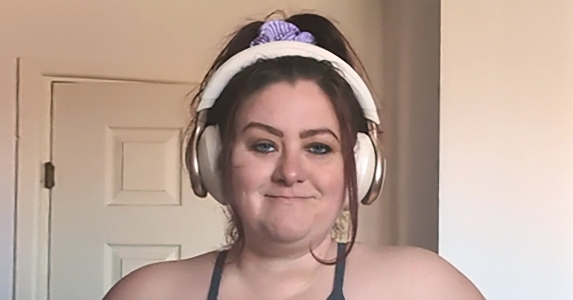 Shocking photo reveals giant 'unfixable' hernia in woman's stomach