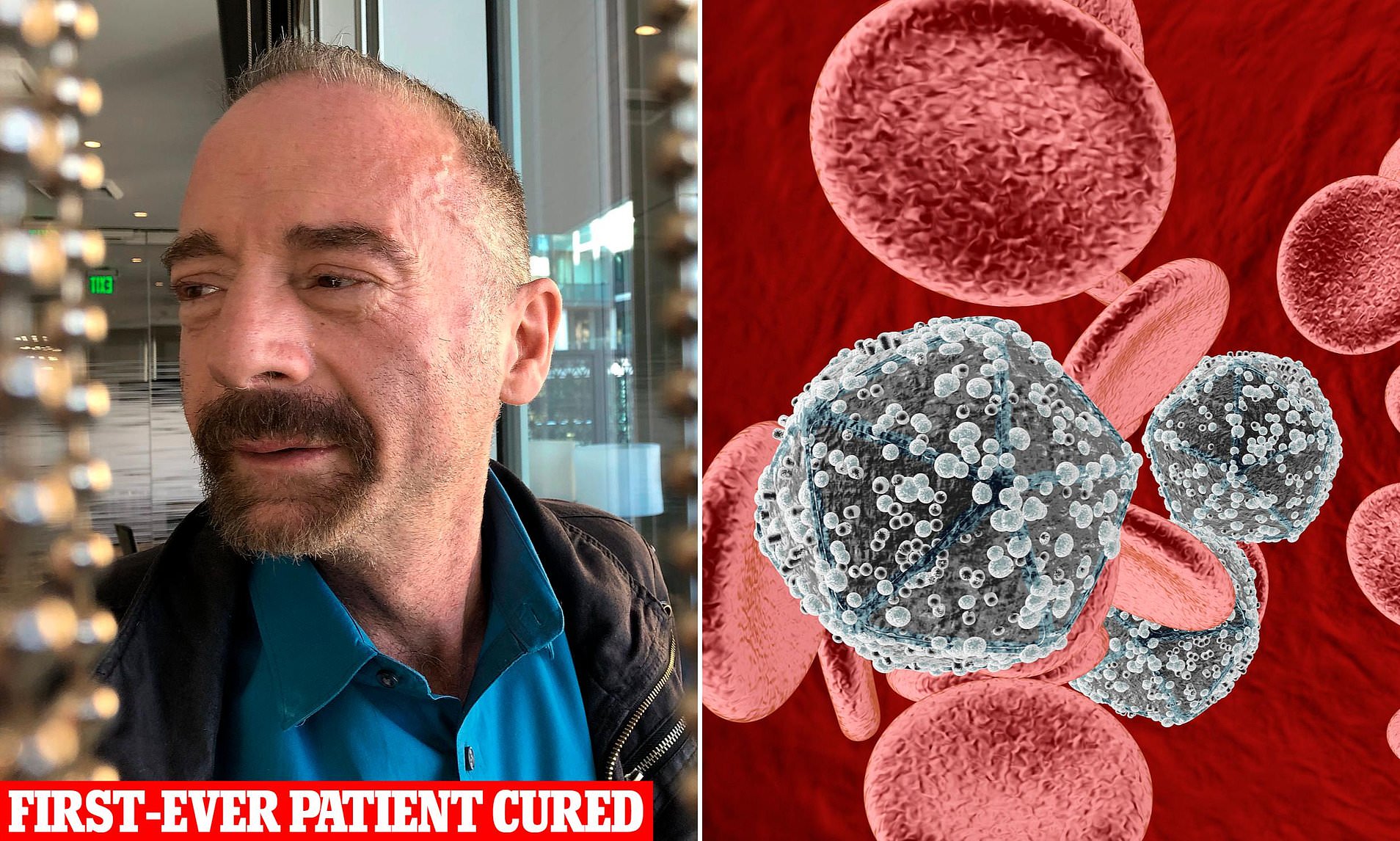 Man cured of HIV through groundbreaking transplant from his brother in ...