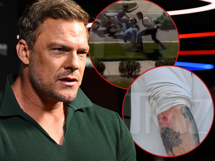 Alan Ritchson injury photos taken by cops after street fight with neighbor