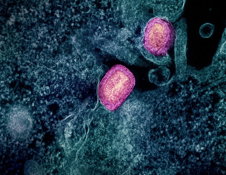 SF health officials urge vaccinations after new case of monkeypox reported