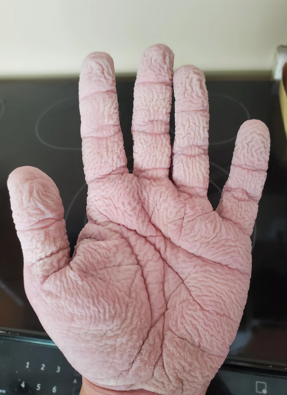 A close-up of a hand with wrinkled skin, possibly due to prolonged exposure to water