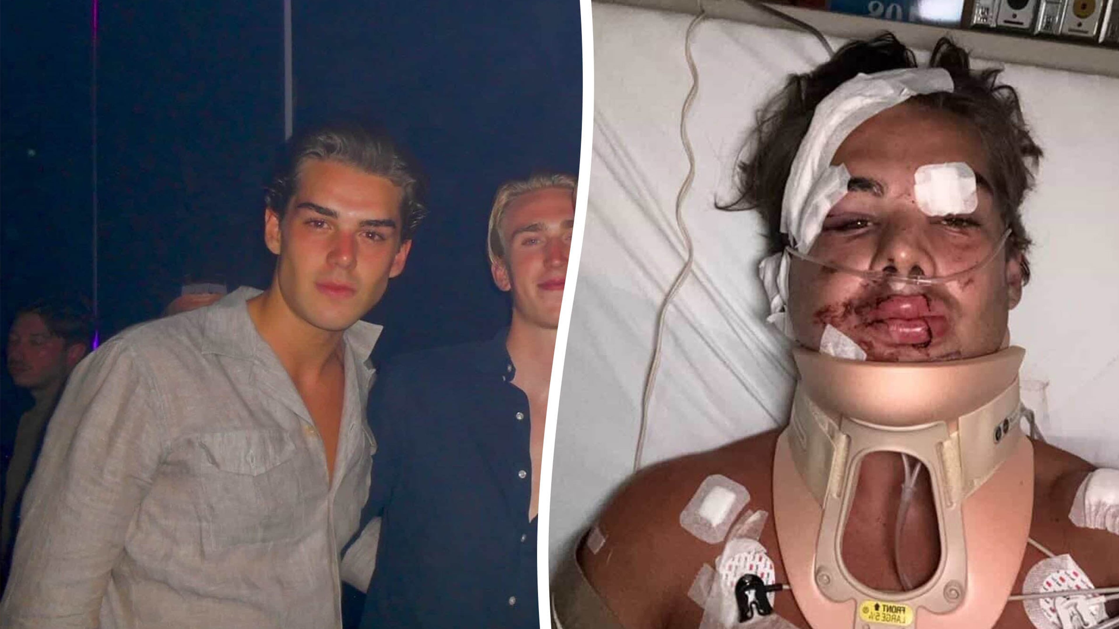 Tourist left with 149 stitches and ear hanging off after Thai moped crash