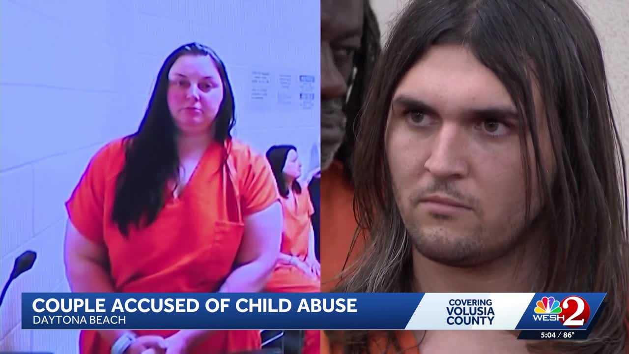 Couple arrested after child shows up to school with visible injuries ...
