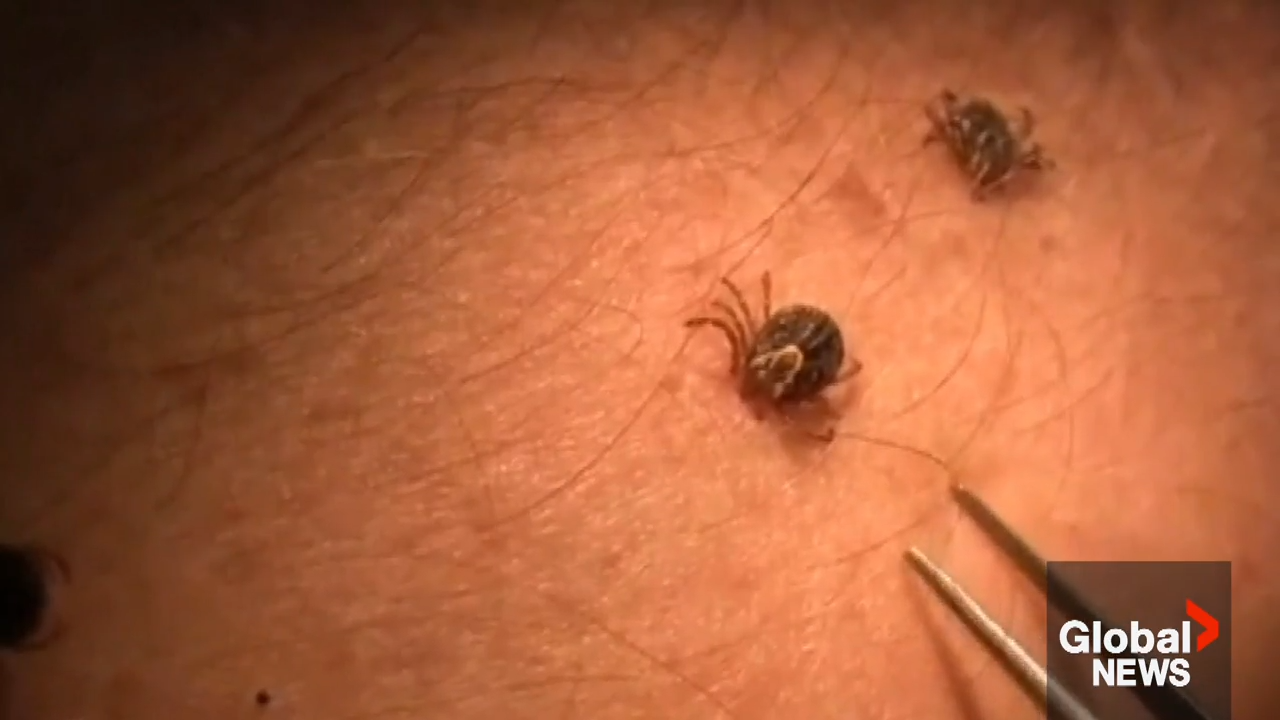 Tips on tackling ticks this summer