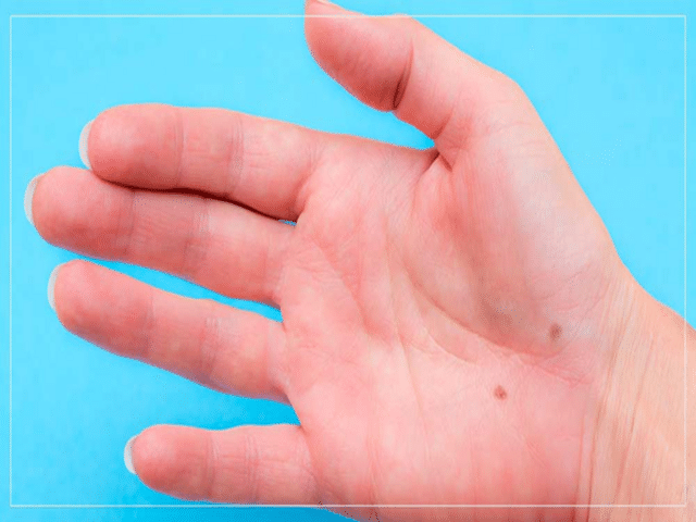 Akhand Laxmi Yoga: If you possess these auspicious signs on your hands ...