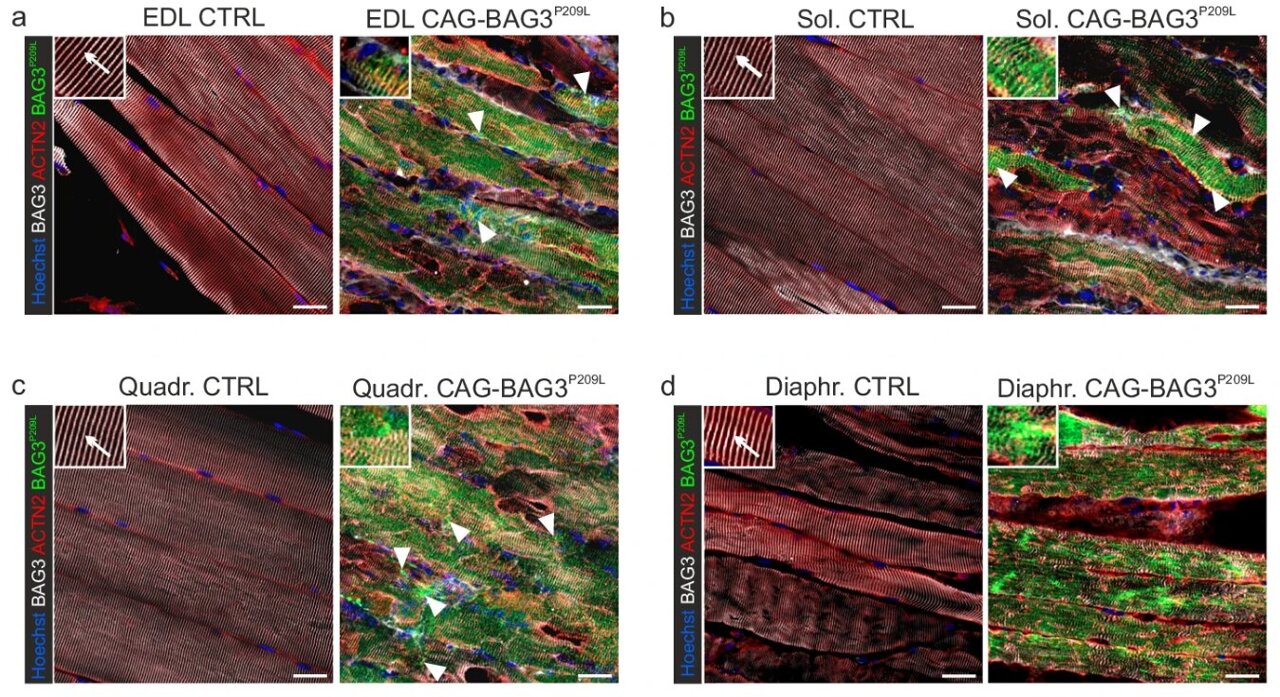 Impaired cell recycling leads to muscle weakness in rare genetic disorder