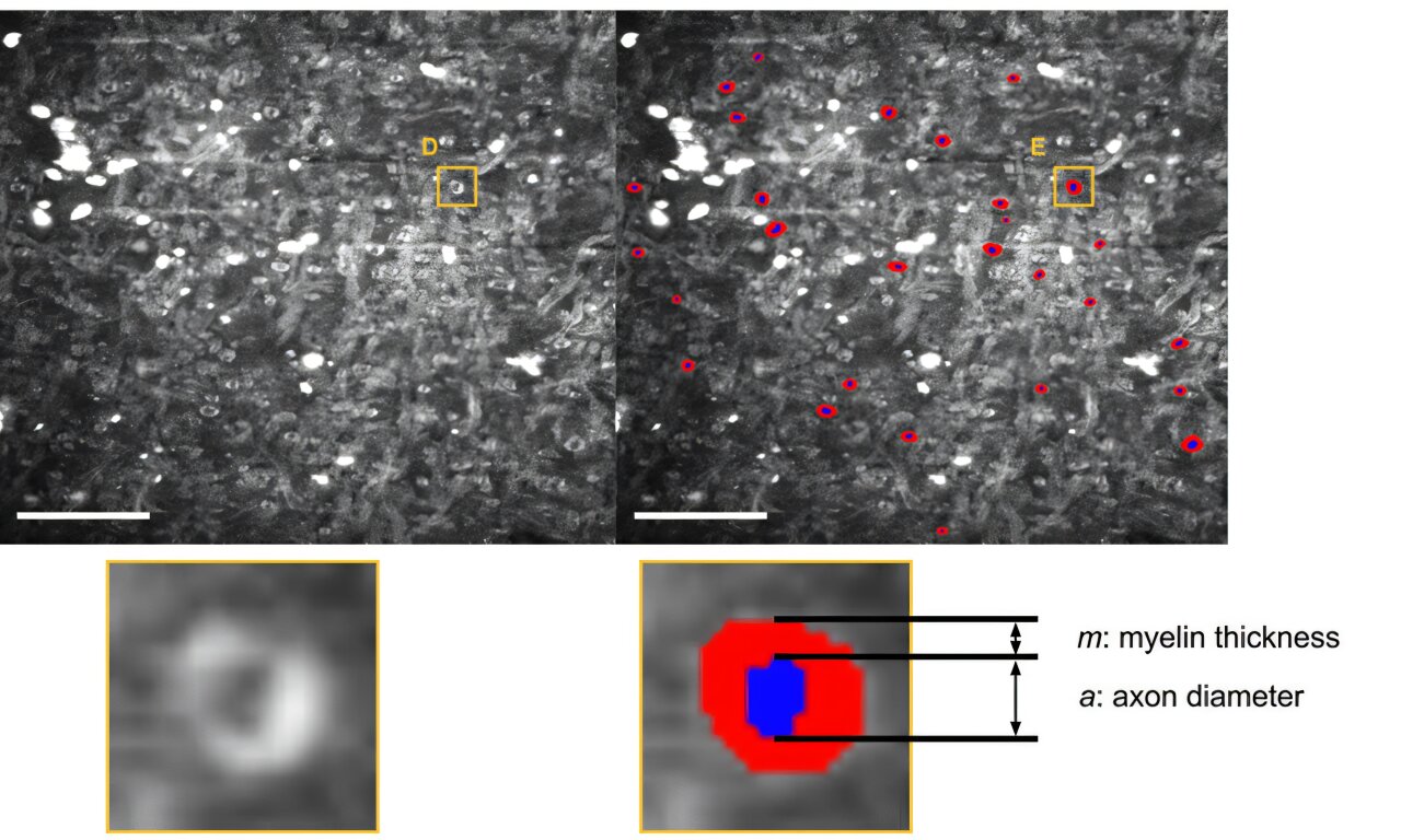 Label-free optical imaging enables automated measurement of human white ...