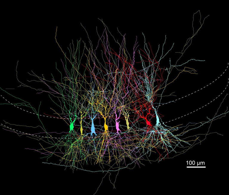 Why newborn memory circuits start crowded, then slim down as brains mature