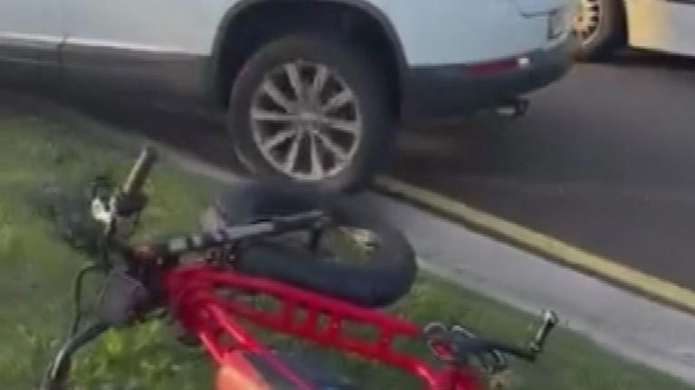 The teenage e-bike rider was taken to hospital with serious leg injuries.
