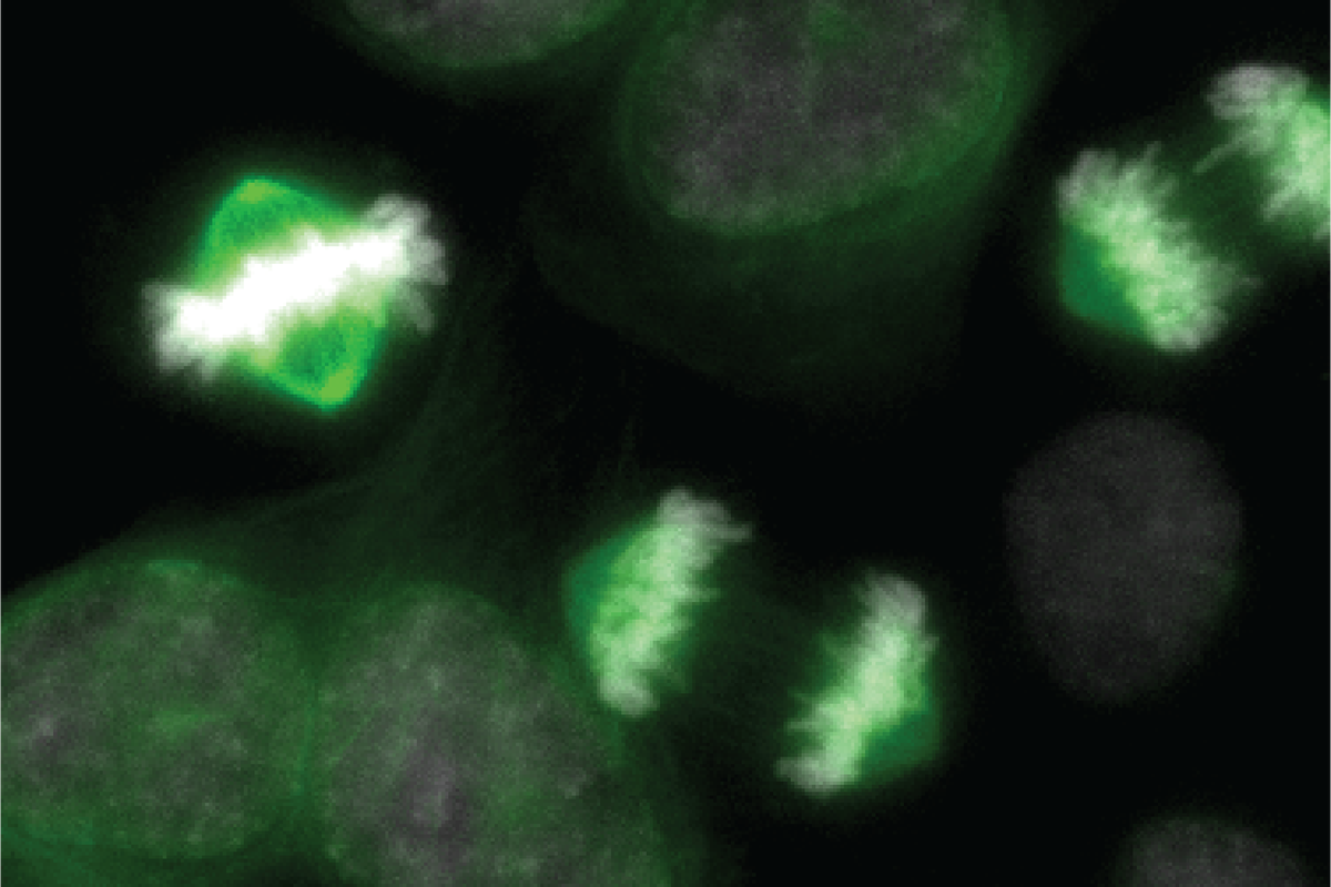 Study of cellular 'light switches' could spark new cancer treatments